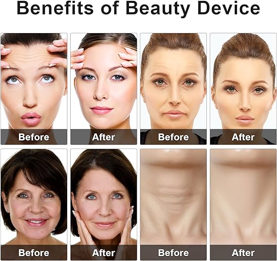 Image of Eye Beauty Device